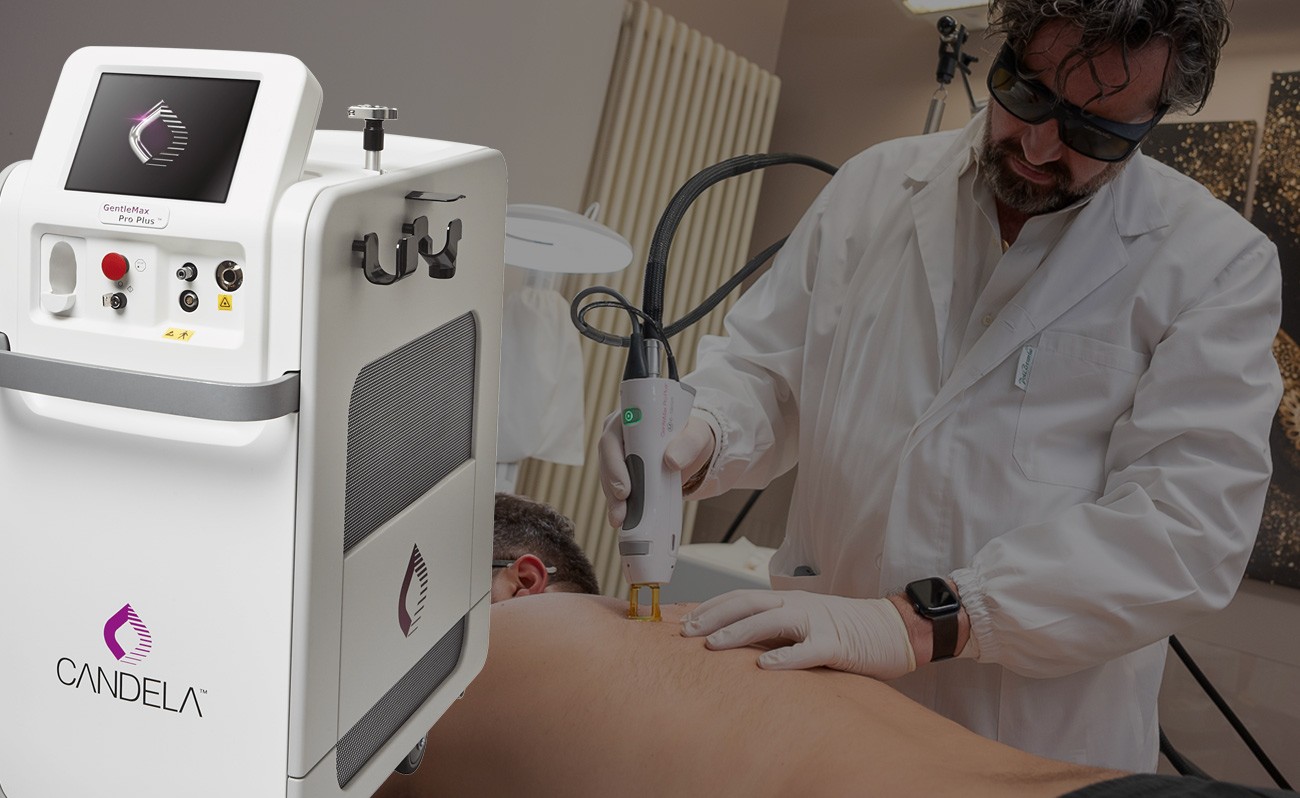 Dr. Brunelli - Candela Laser Gentle Max Pro Plus per epilazione